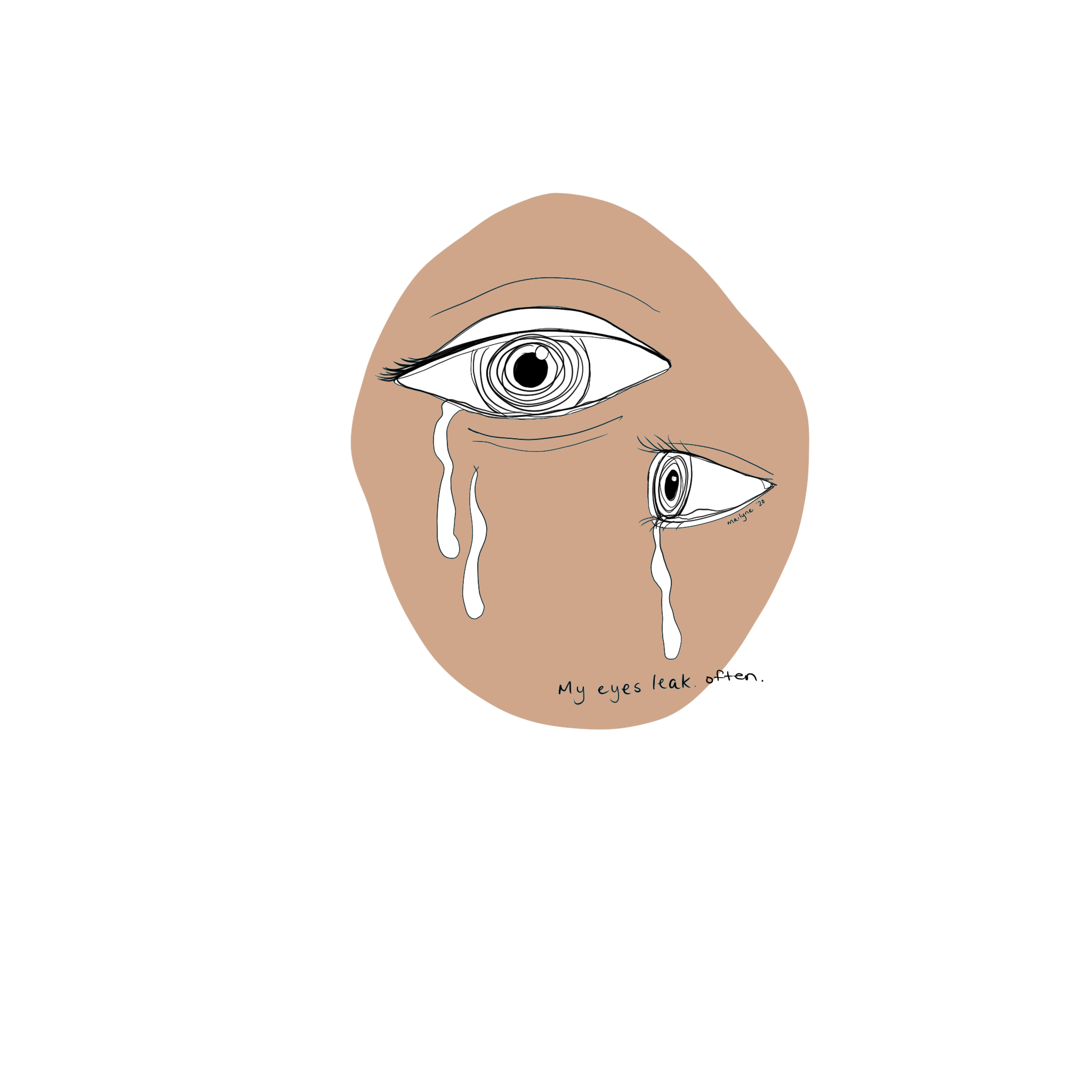 Illustration of two eyes crying with text that says my eyes leak often.